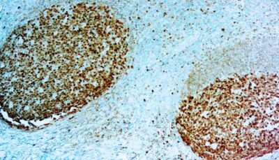 BOB.1 BOB.1 Antibody DBS